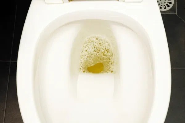 Why is my urine foamy? 4 bf18f3a3 d493 4ffb b9c0 980d86712a1c